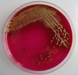 Az Escherichia coli baktérium (E. coli)